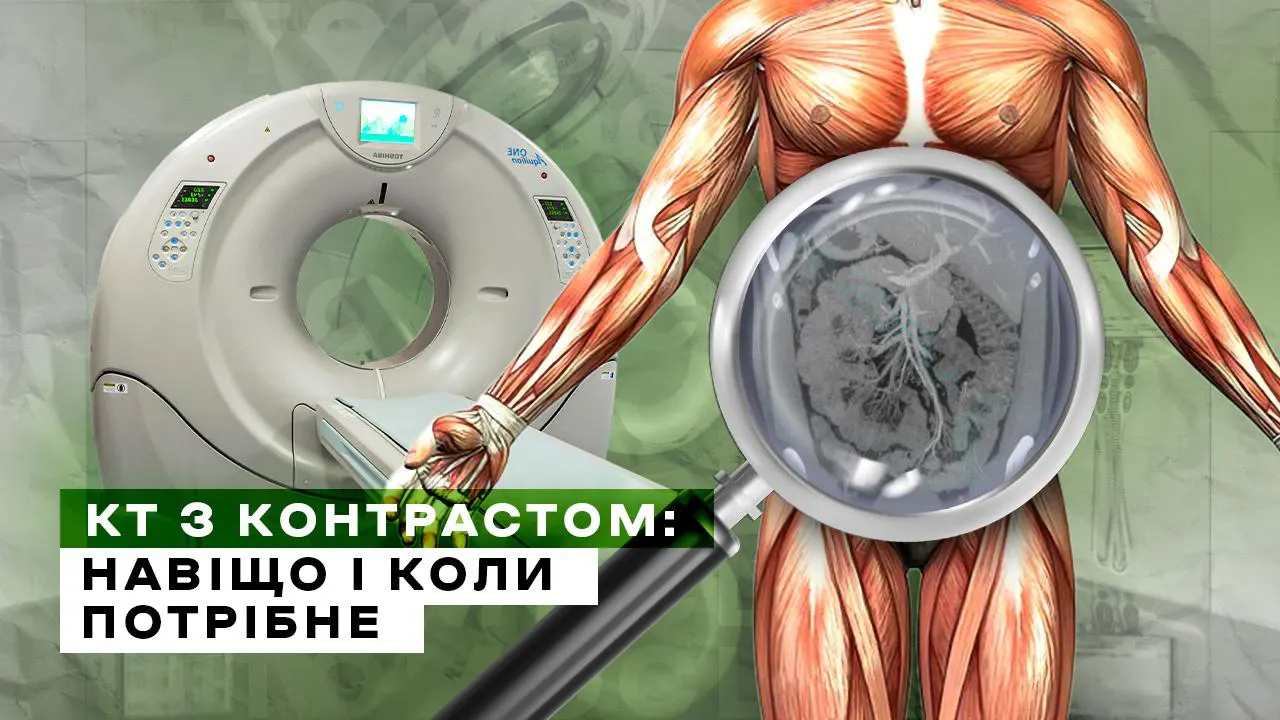 КТ з контрастом: навіщо і коли потрібне