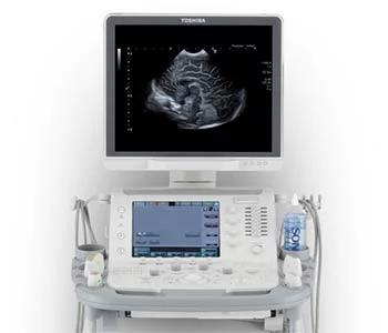Detailed imaging with the TOSHIBA Aplio ™ 500 Platinum Ultrasound