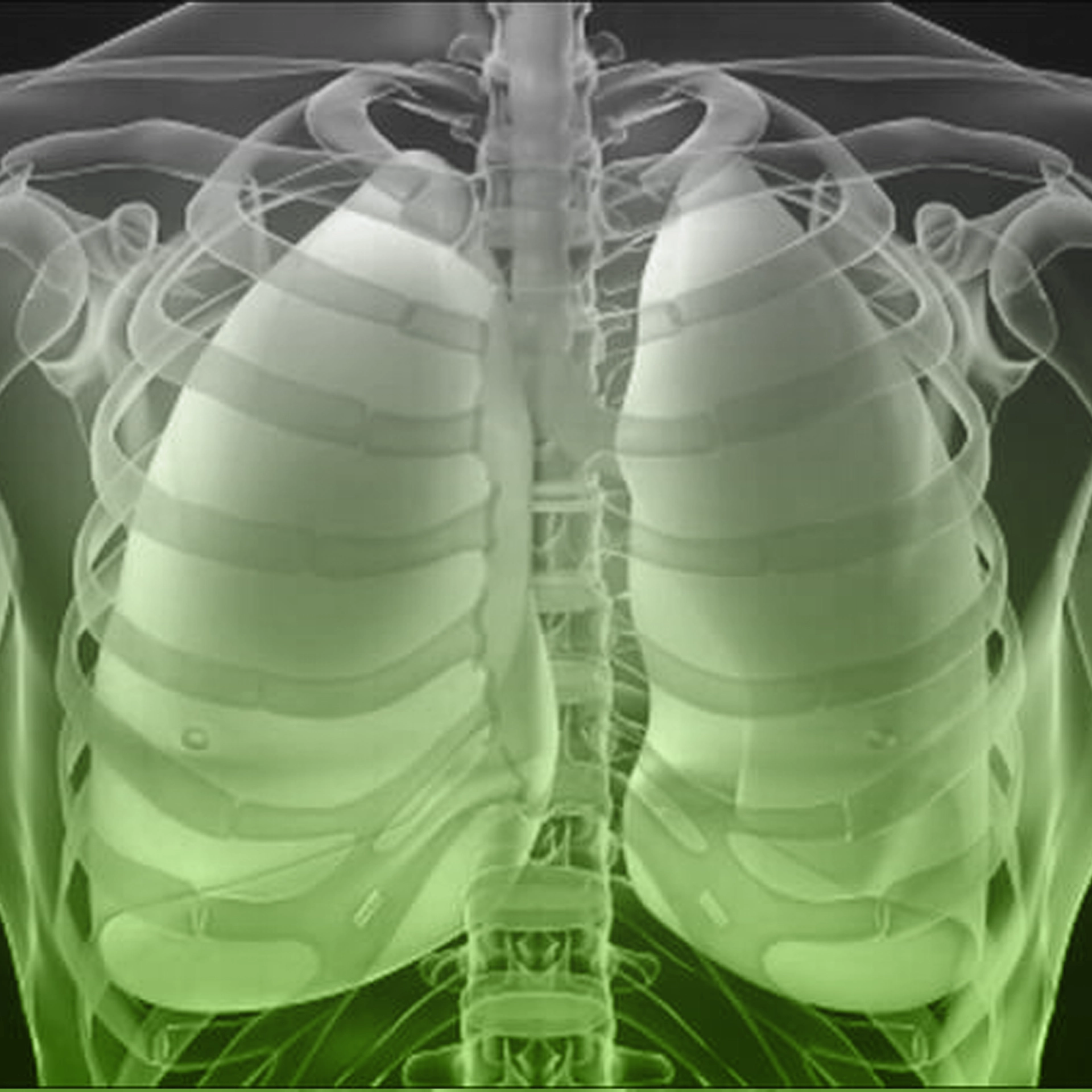 Комп’ютерна томографія легень