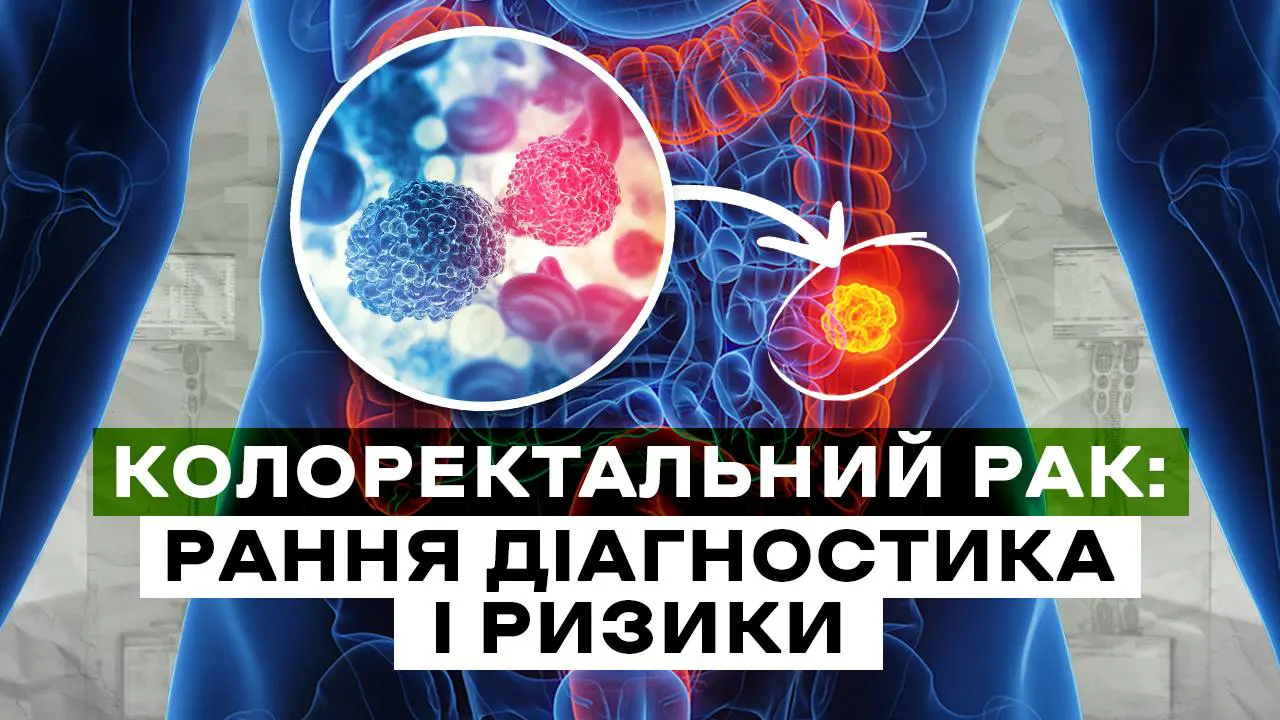 Колоректальний рак: рання діагностика і ризики