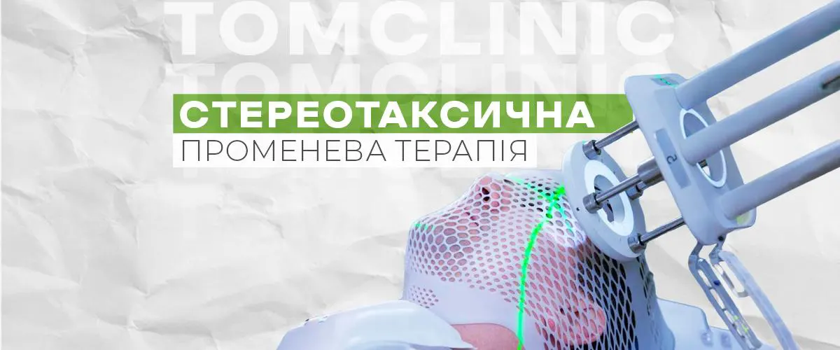 Стереотаксична променева терапія: коли вона ефективніша за традиційне лікування