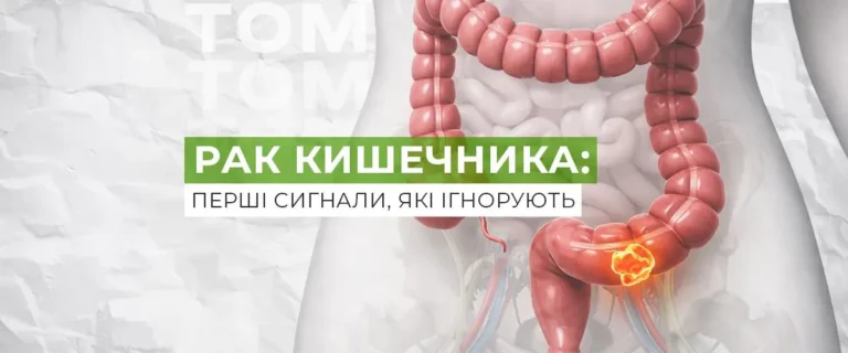 Рак кишечника: перші симптоми, які люди роками ігнорують