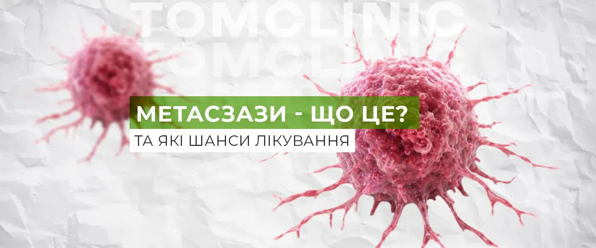 Метастази: що це означає і чи є шанс на лікування?