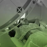 Променева терапія при раку стравоходу