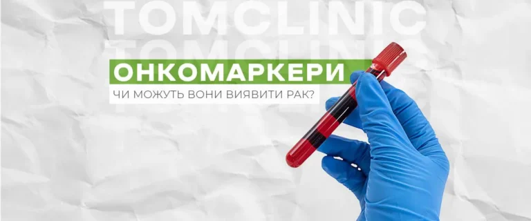 Онкомаркери: що показують та чи можна за ними визначити рак?