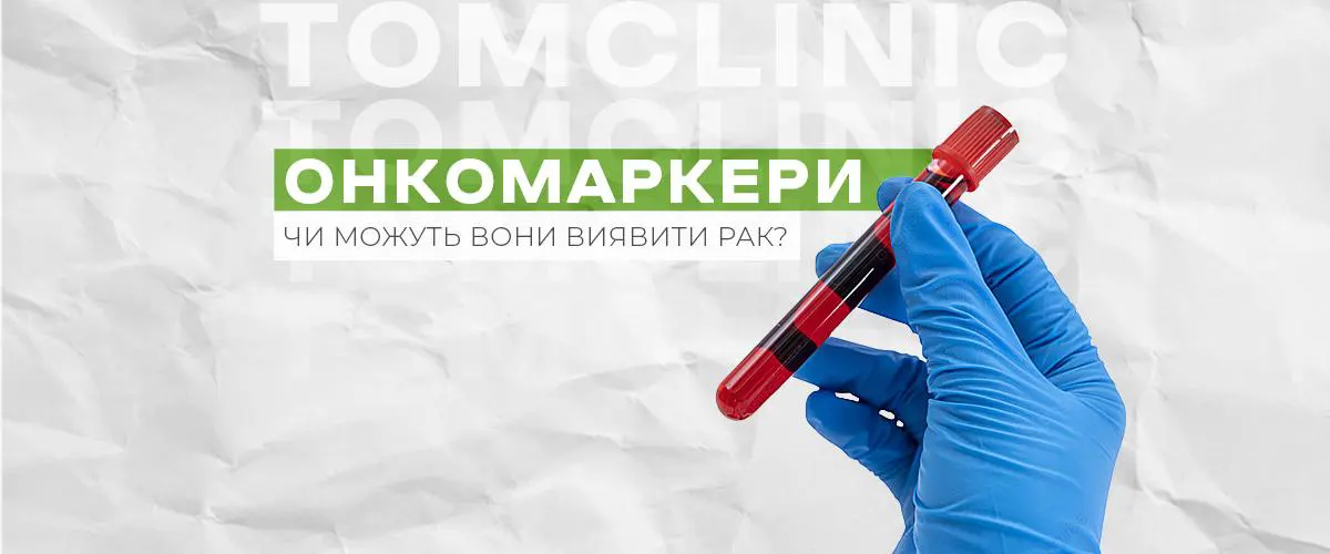 Онкомаркери: що показують та чи можна за ними визначити рак?