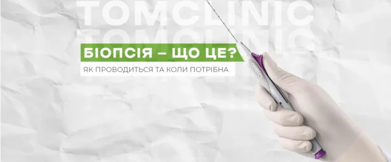 Біопсія: що це, як проводиться та коли її призначають?